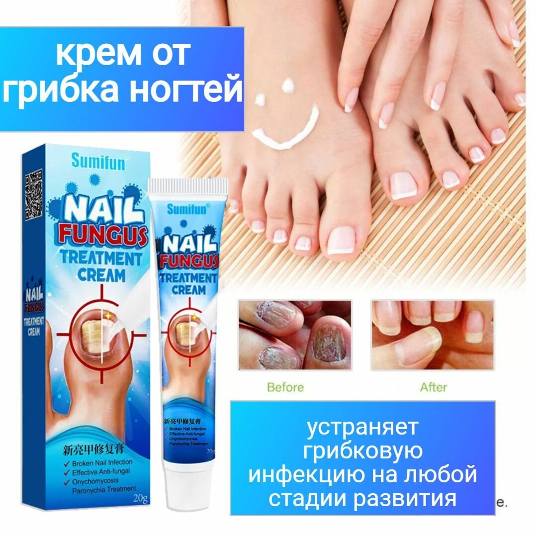 Мазь грибковая для ногтей — купить в интернет-магазине по низкой цене ...