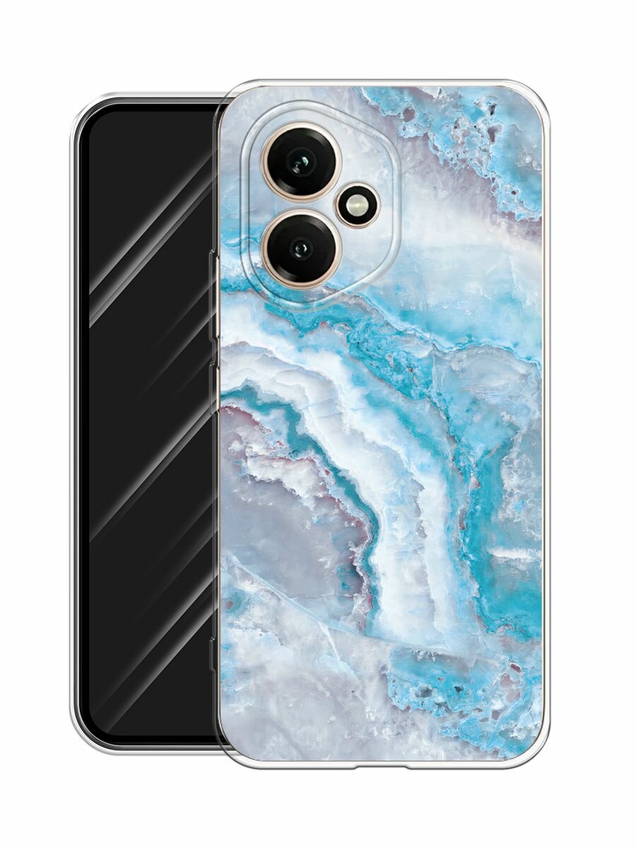 Чехол на Honor 400 / Хонор 400 с принтом "Нежно-голубой мрамор" — фото 1