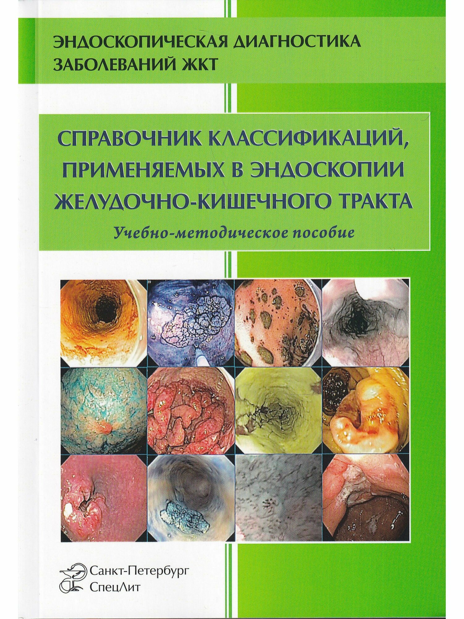 Справочник классификаций, применяемых в эндоскопии ЖКТ