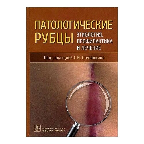 Патологические рубцы. Этиология, профилактика и лечение - фото №2