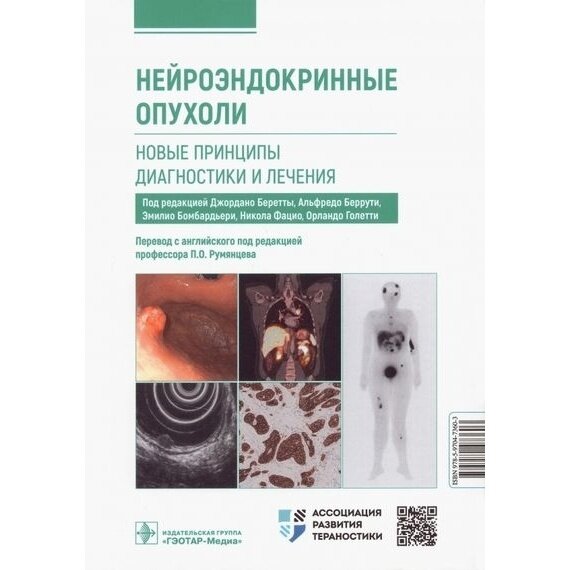 Нейроэндокринные опухоли. Новые принципы диагностики и лечения. Руководство - фото №3