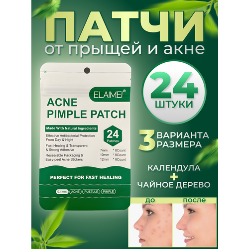 Прозрачные патчи-стикеры наклейки лечебные от прыщей, угрей и акне подсушивающие противоспалительные - 24 шт