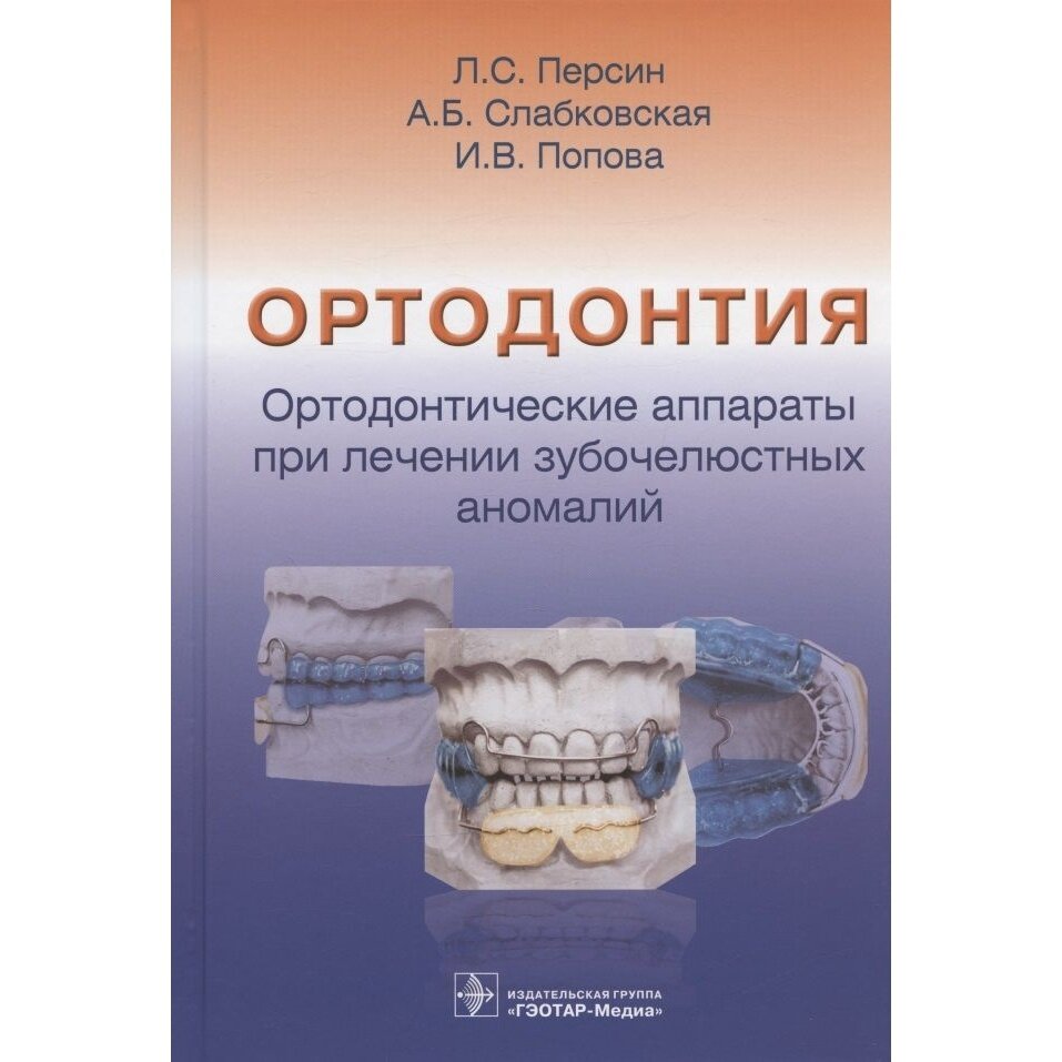 Ортодонтия Ортодонтические аппараты при лечении зубочелюстных аномалий - фото №3