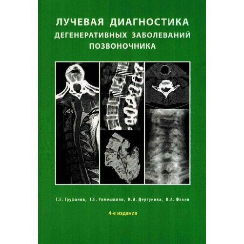 Труфанов Г. Е, Рамешвили Т. Е, Дергунова Н. И, Фок "Лучевая диагностика дегенеративных заболеваний позвоночника: илл. руководство.- 4-е изд"