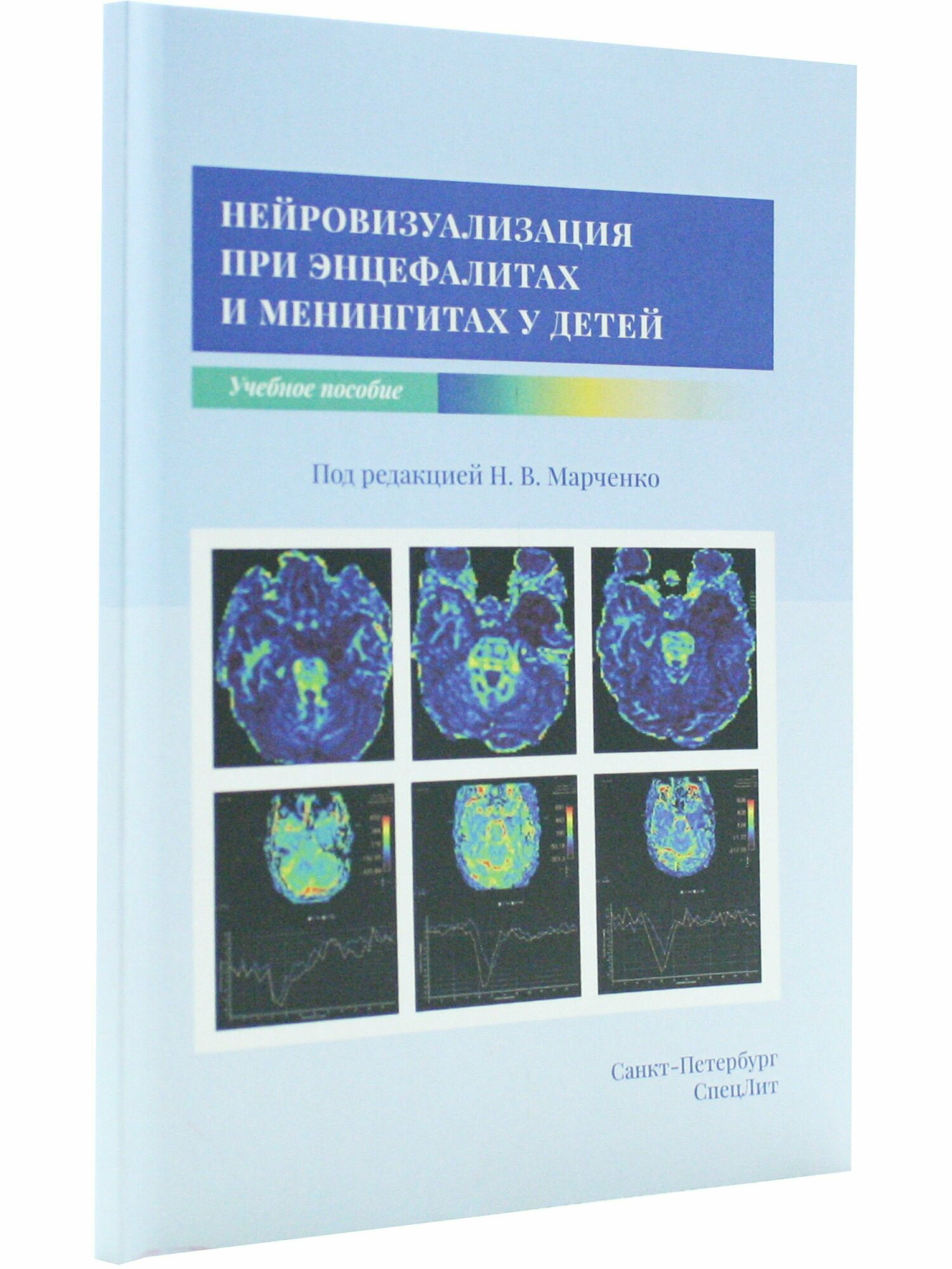 Нейровизуализация при энцефалитах и менингитах у детей. Учебное пособие - фото №3