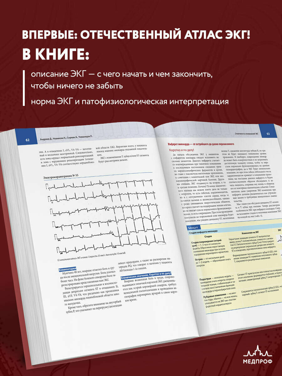 Новикова Н. А, Чомахидзе П. Ш, Андреев "Атлас электрокардиографии. Интерпретация результатов: от простого к сложному"