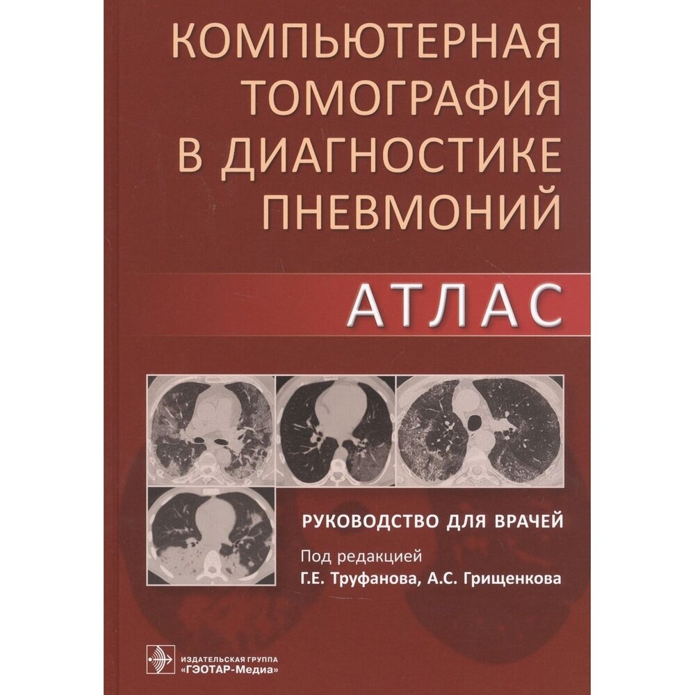 Компьютерная томография в диагностике пневмоний. Атлас - фото №9