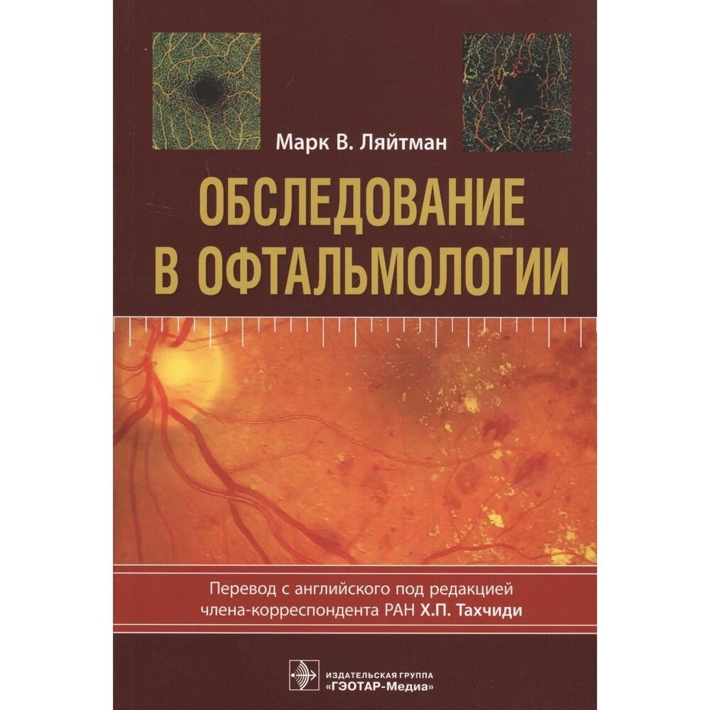 Обследование в офтальмологии. Руководство - фото №3