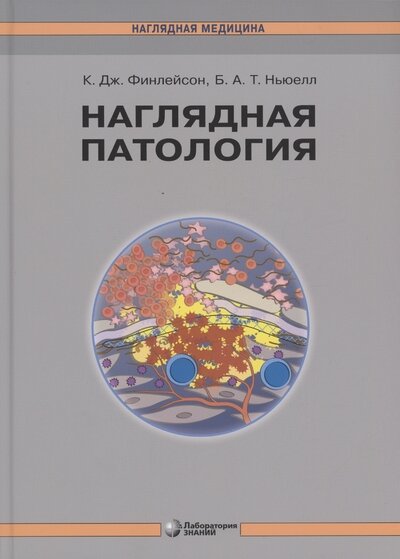 Финлейсон К, Ньюэлл Б. "Наглядная патология"