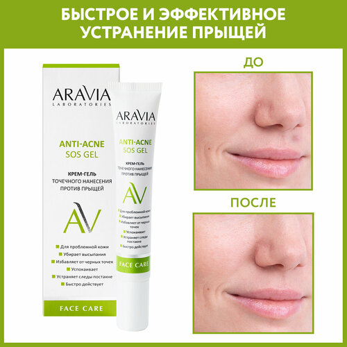 ARAVIA Крем-гель точечного нанесения против прыщей Anti-Acne SOS Gel, 20 мл гель для точечного нанесения против воспалений icon skin sos treatment 20 мл