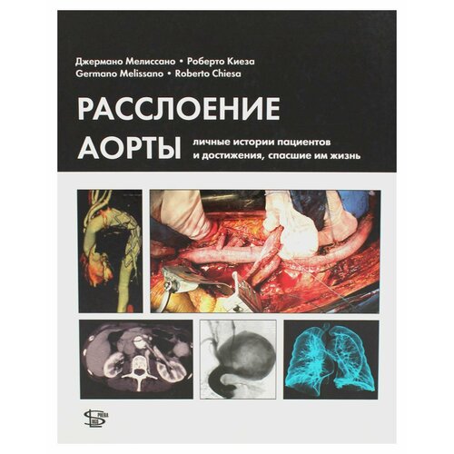 Расслоение аорты: личные истории пациентов и достижения, спасшие им жизнь. Мелиссано Дж, Киеза Р. Логосфера