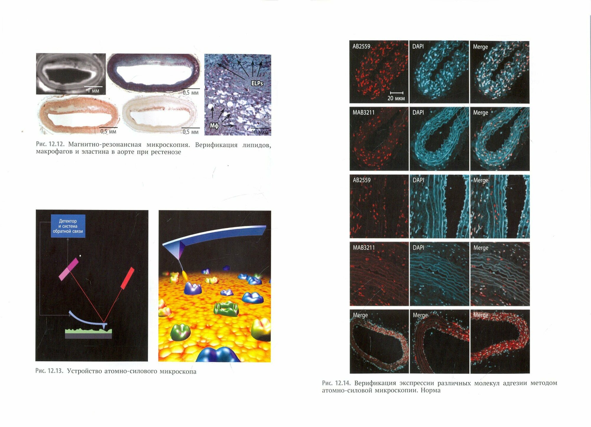 Артериальный рестеноз. Молекулярно-биомедицинские аспекты - фото №2
