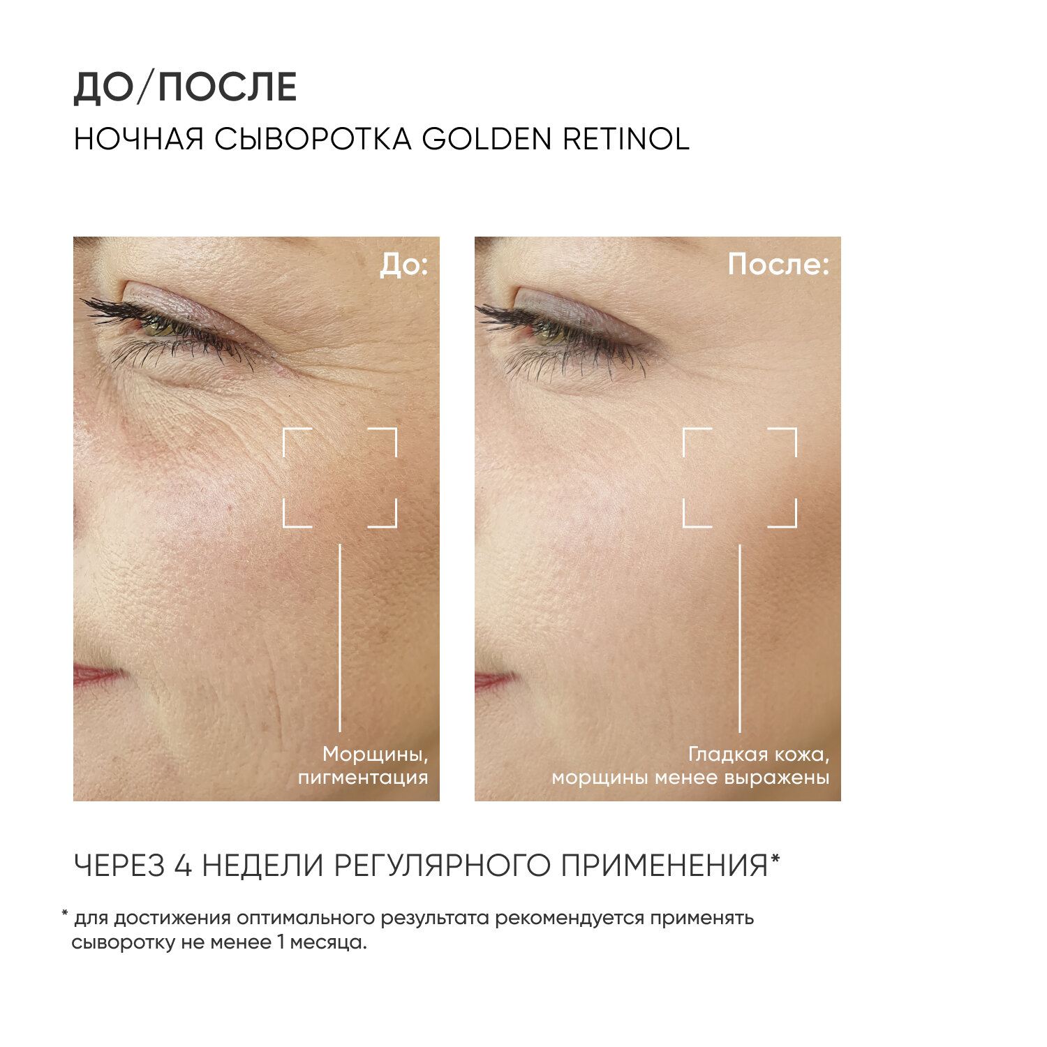Ночная сыворотка на основе 0,35% ретинола Golden Retinol, 30 мл Icon Skin - фото №4