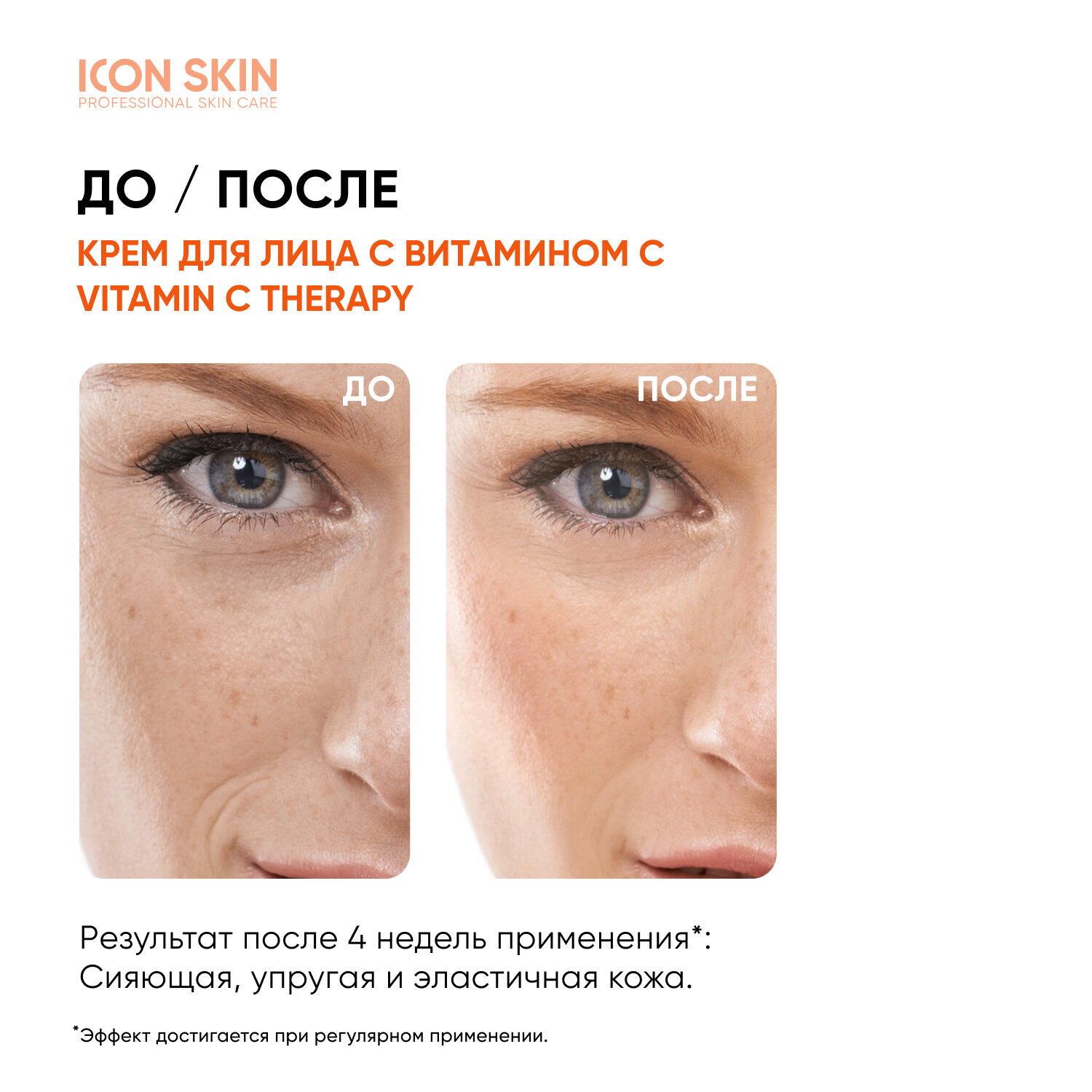 ICON SKIN Крем-сияние для лица Vitamin C Therapy с витамином С и морским коллагеном увлажняющий для всех типов кожи, 30 мл