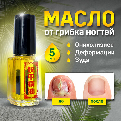 Масло для ногтей средство для лечения грибка и онихолизиса, SilaVeres, 5 мл