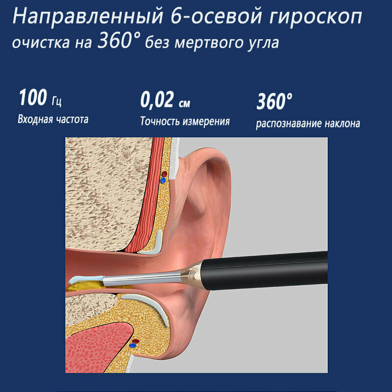 Инструмент для чистки ушей, Умная ушная палочка, Косметические аппараты для ушей, Ушная палочка, Отоскоп - фотография № 7