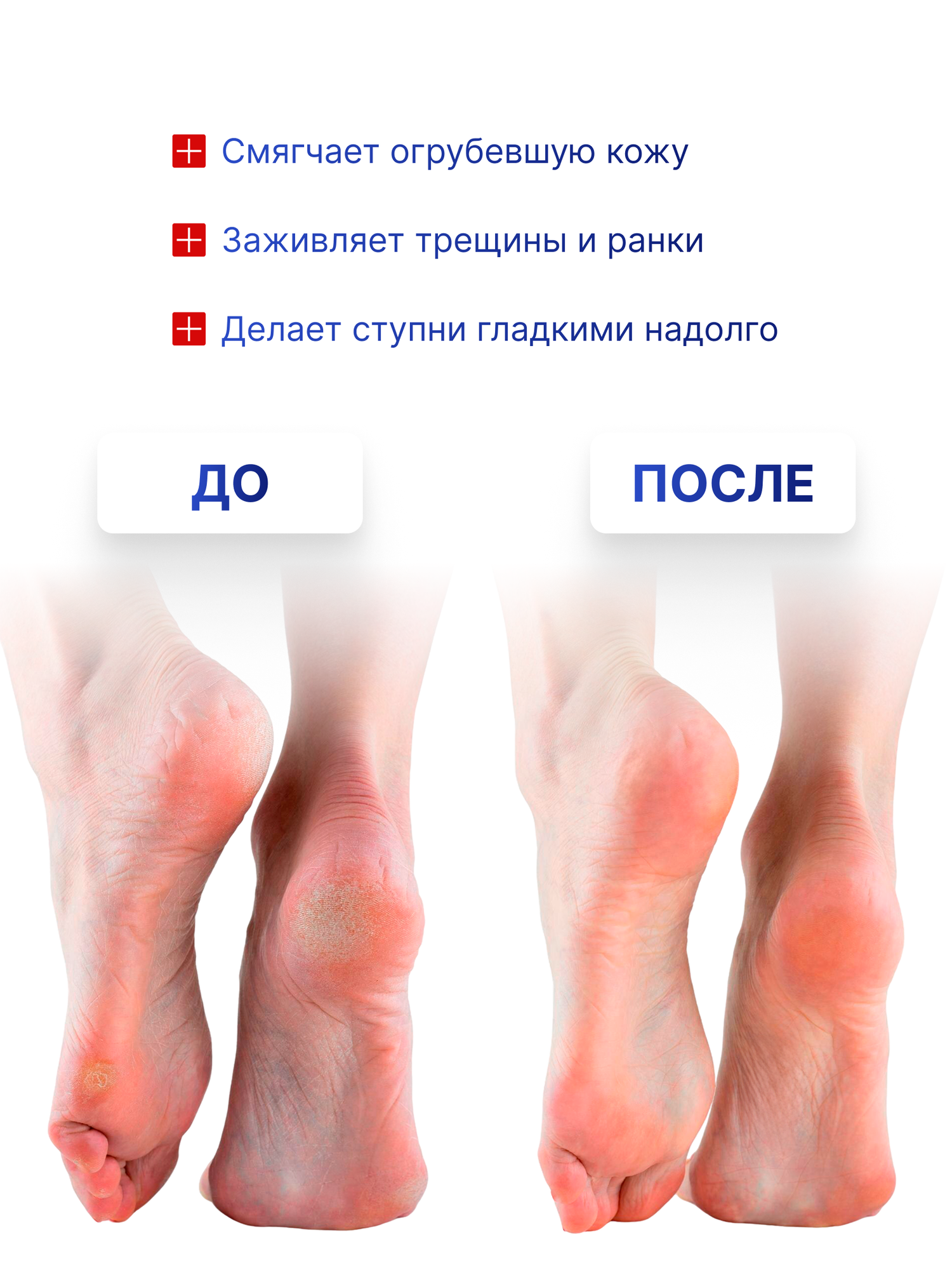 Картинки Крем для ног с мочевиной, бальзам от сухости и трещин Dr.Foot, 75 мл
