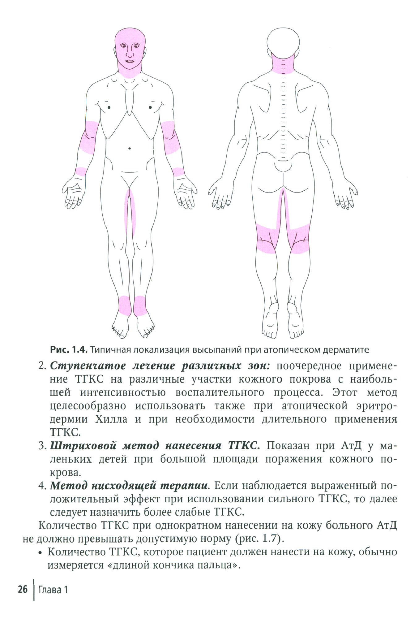 Дерматозы, ассоциированные с бактериальной и микотической инфекцией. Руководство - фото №2