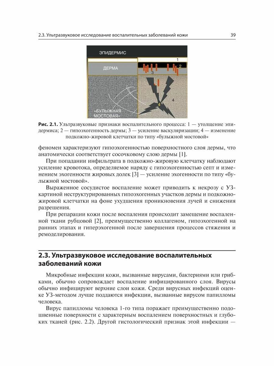 Визуализация в дерматологии (Бард Р. (ред.)) - фото №6