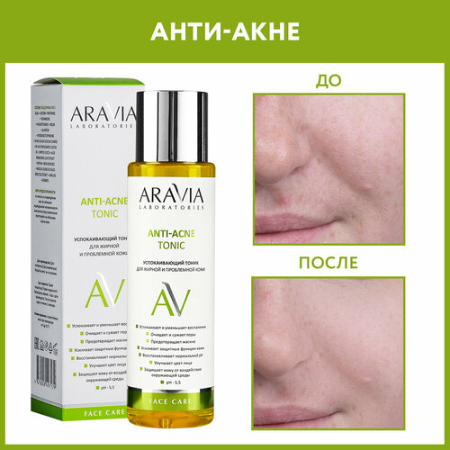 ARAVIA Успокаивающий тоник для жирной и проблемной кожи Anti-acne tonic, 250 мл успокаивающий тоник для жирной и проблемной кожи aravia laboratories anti acne tonic 250 мл