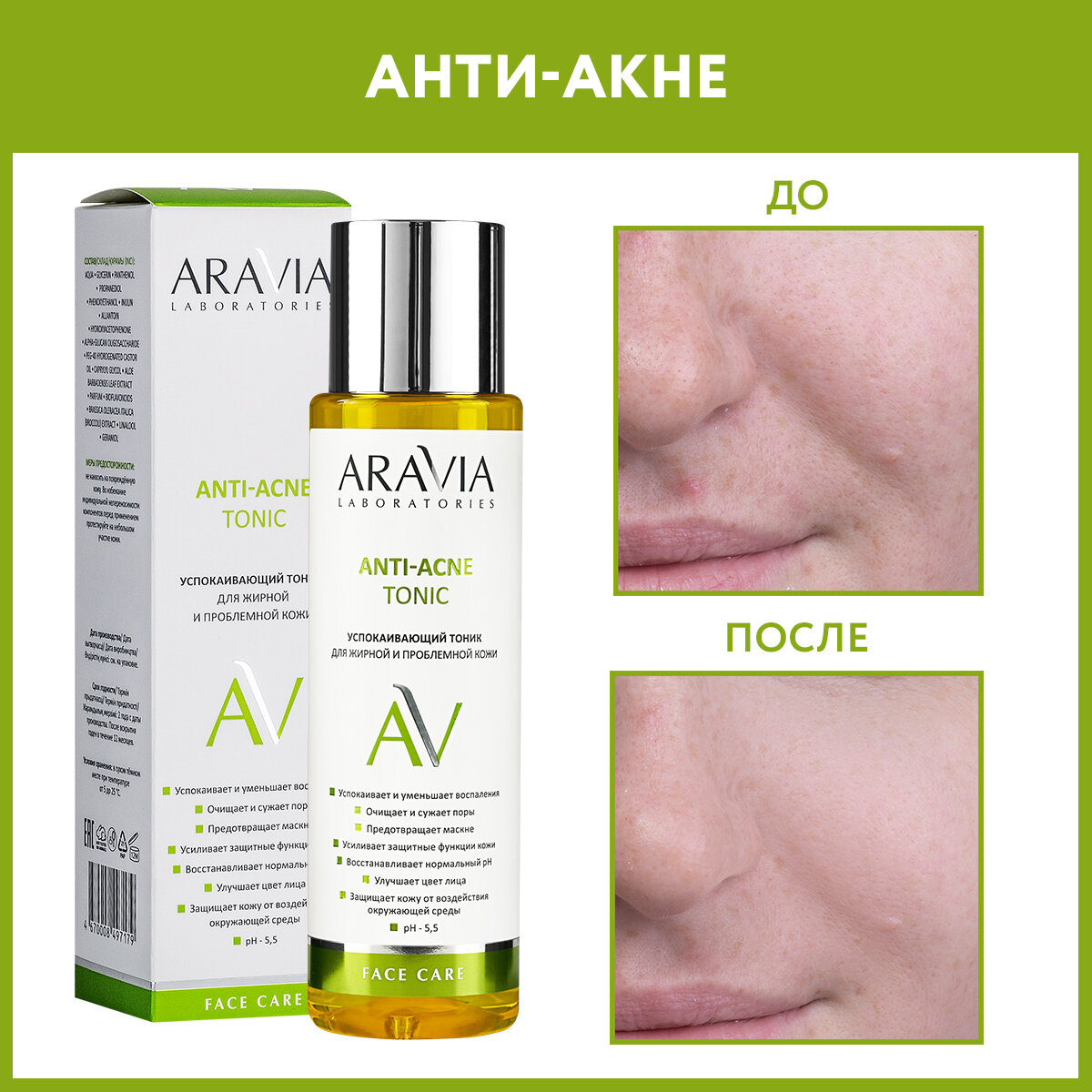 ARAVIA Успокаивающий тоник для жирной и проблемной кожи Anti-acne tonic, 250 мл