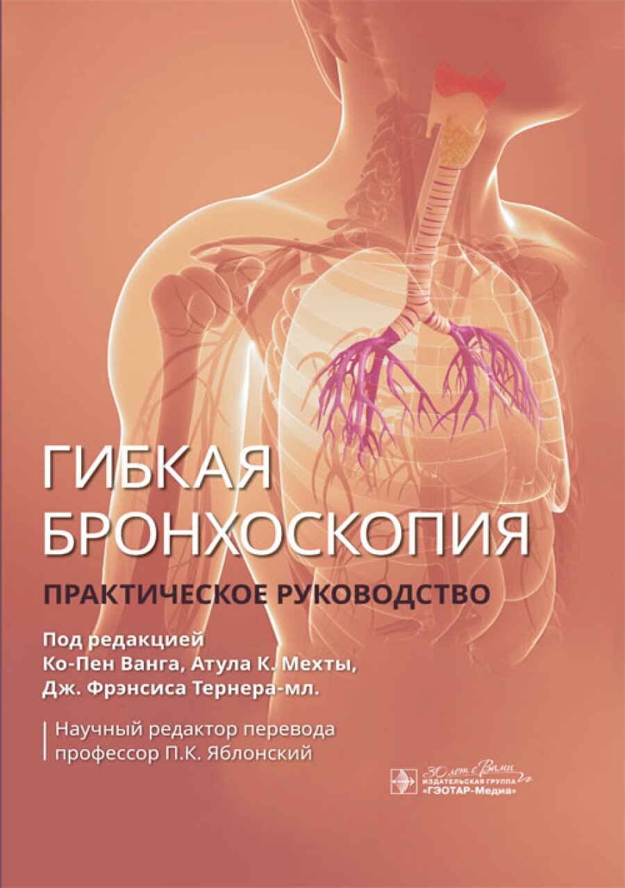 Гибкая бронхоскопия : практическое руководство