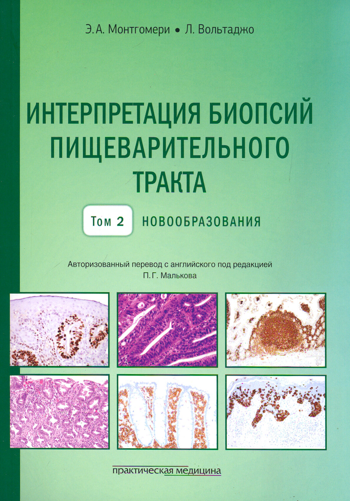 Интерпретация биопсий пищеварительного тракта. Том 2. Новообразования