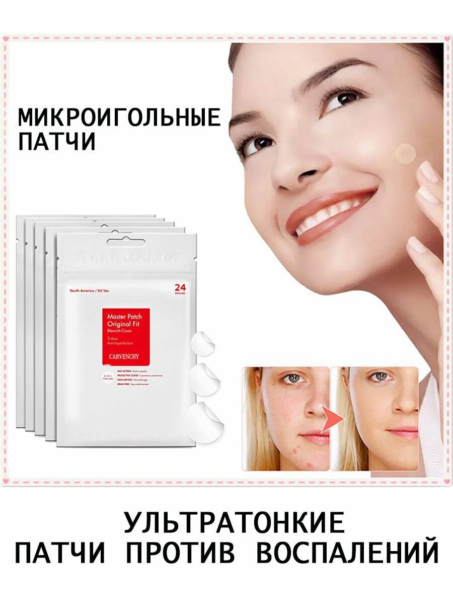 Патчи пластырь от прыщей на лице Master Patch Acne гидроколлоидные 24 шт.