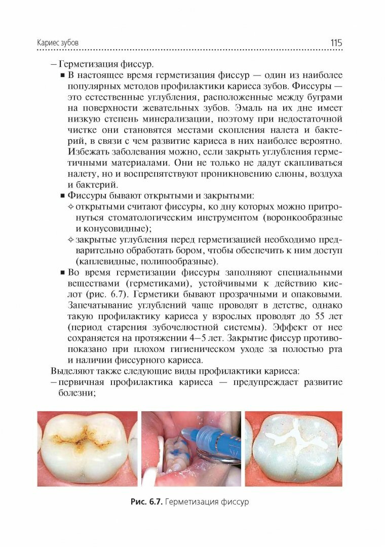 Стоматологические заболевания. Учебник для медицинских училищ и колледжей - фото №3