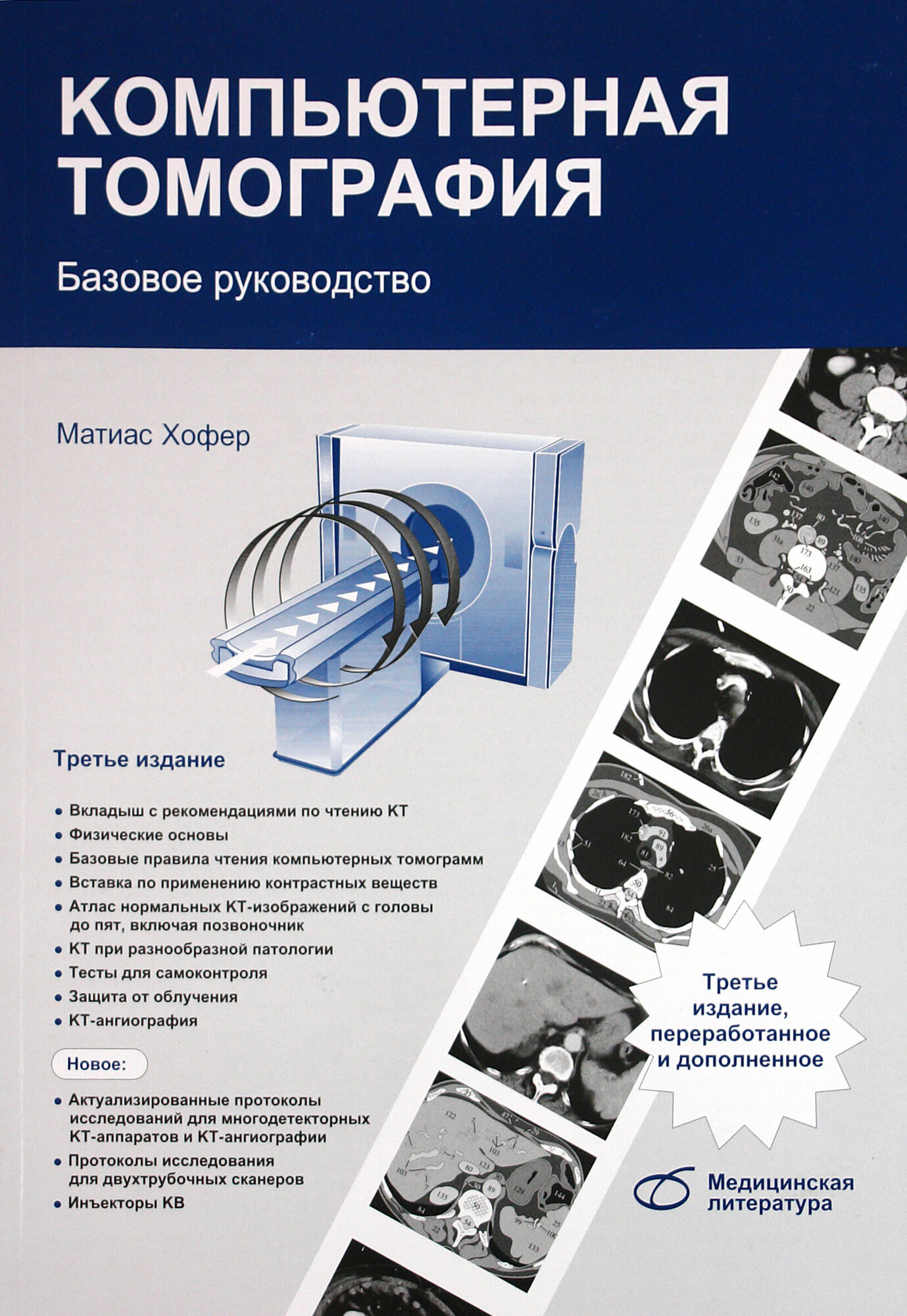 Компьютерная томография. Базовое руководство - фото №3