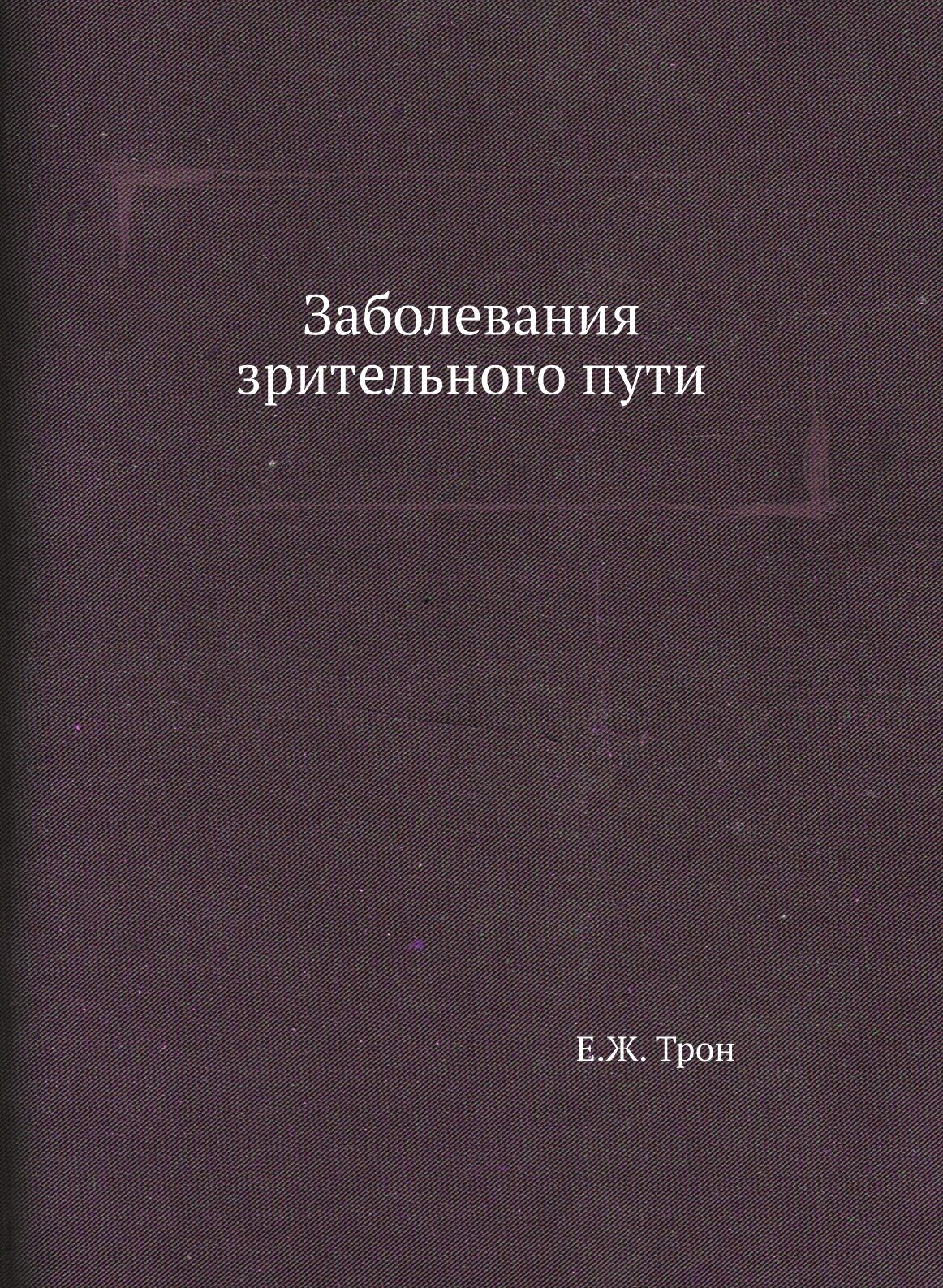 Заболевания зрительного пути