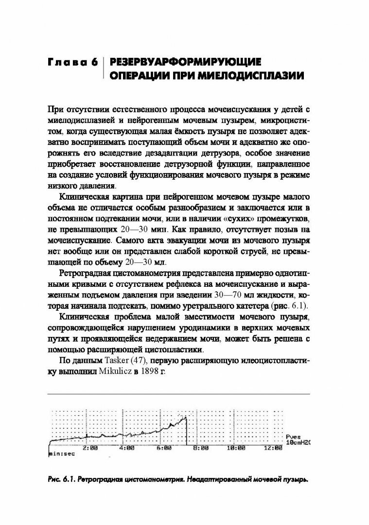 Синдром миелодисплазии у детей (клиника, диагностика, лечение) - фото №13