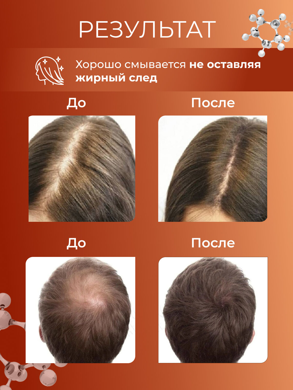 Сыворотка для роста волос — фото 1