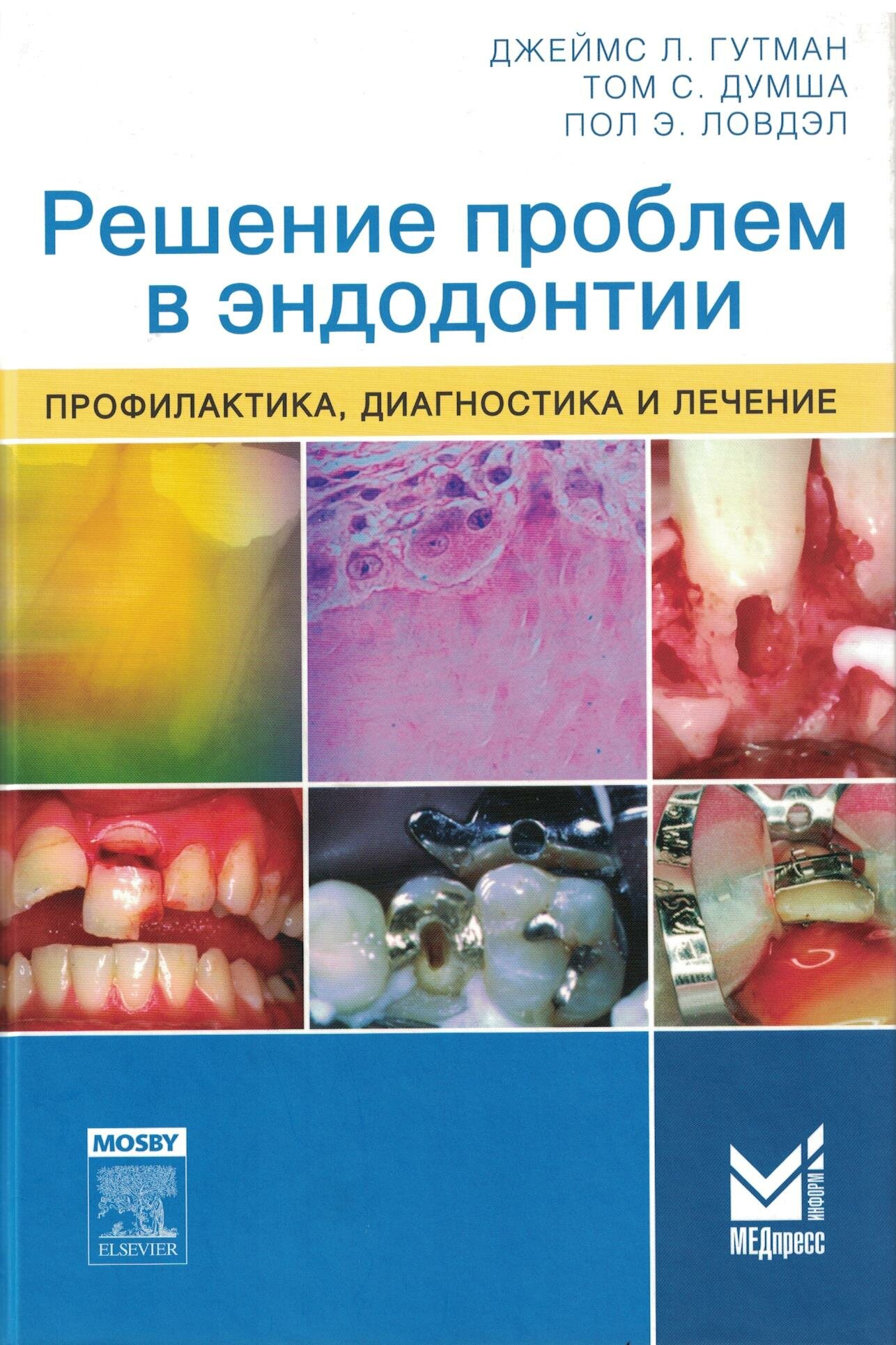 Решение проблем в эндодонтии (Гуиман Д.Л., Ловдэл П.Э., Думша Т.С.) - фото №5