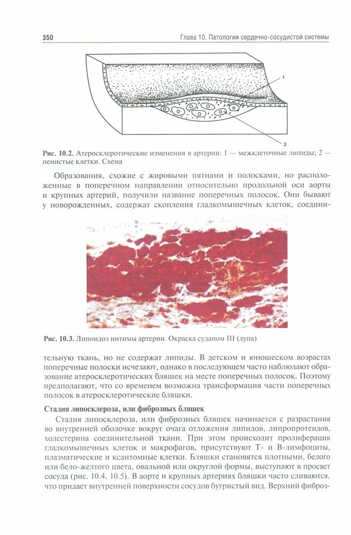 Патологическая анатомия. Учебник. В 2-х томах. Том 1. Общая патология - фото №4