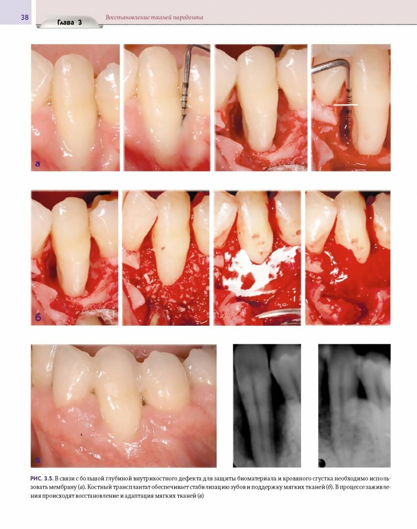 Регенеративные технологии в стоматологии. Научно-практическое руководство - фото №10