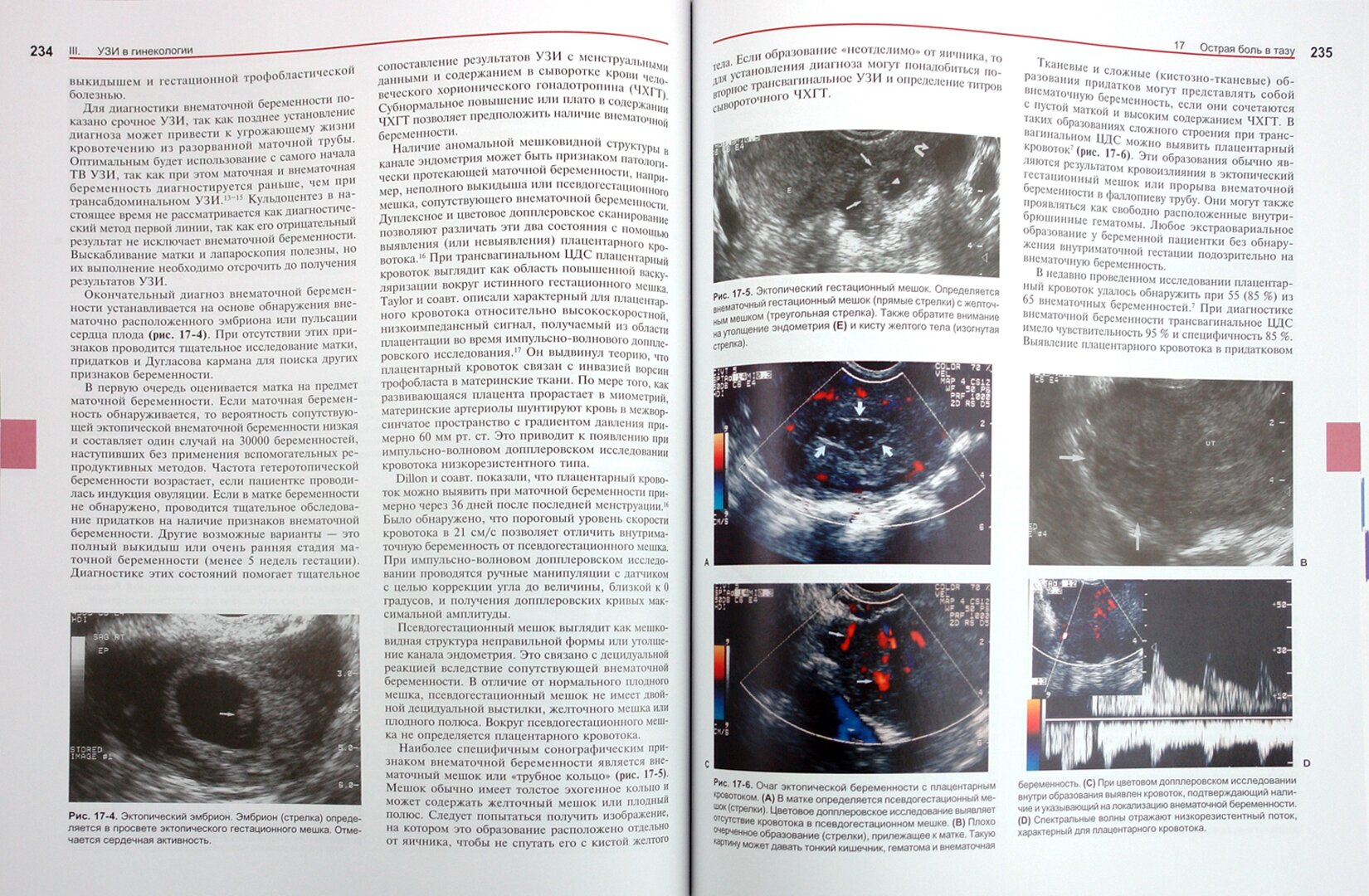 Ультразвуковая диагностика. Практическое решение клинических проблем. Том 2 - фото №5