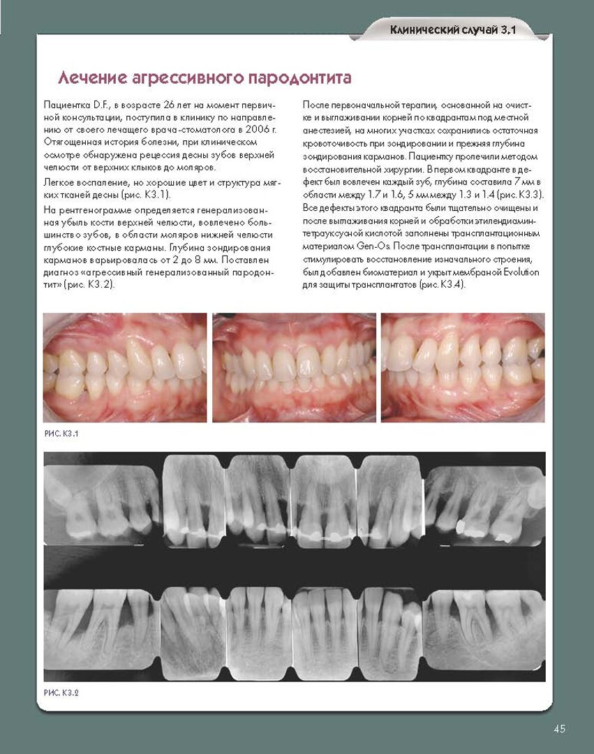 Регенеративные технологии в стоматологии. Научно-практическое руководство - фото №5