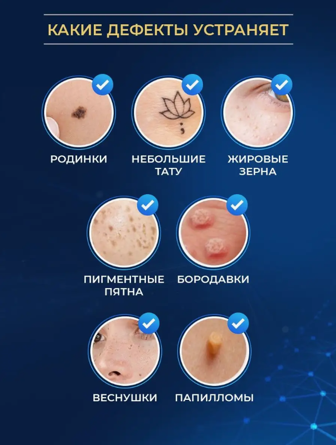 Косметический аппарат для удаления дефектов кожи , Коагулятор от бородавок и папиллом - фотография № 2