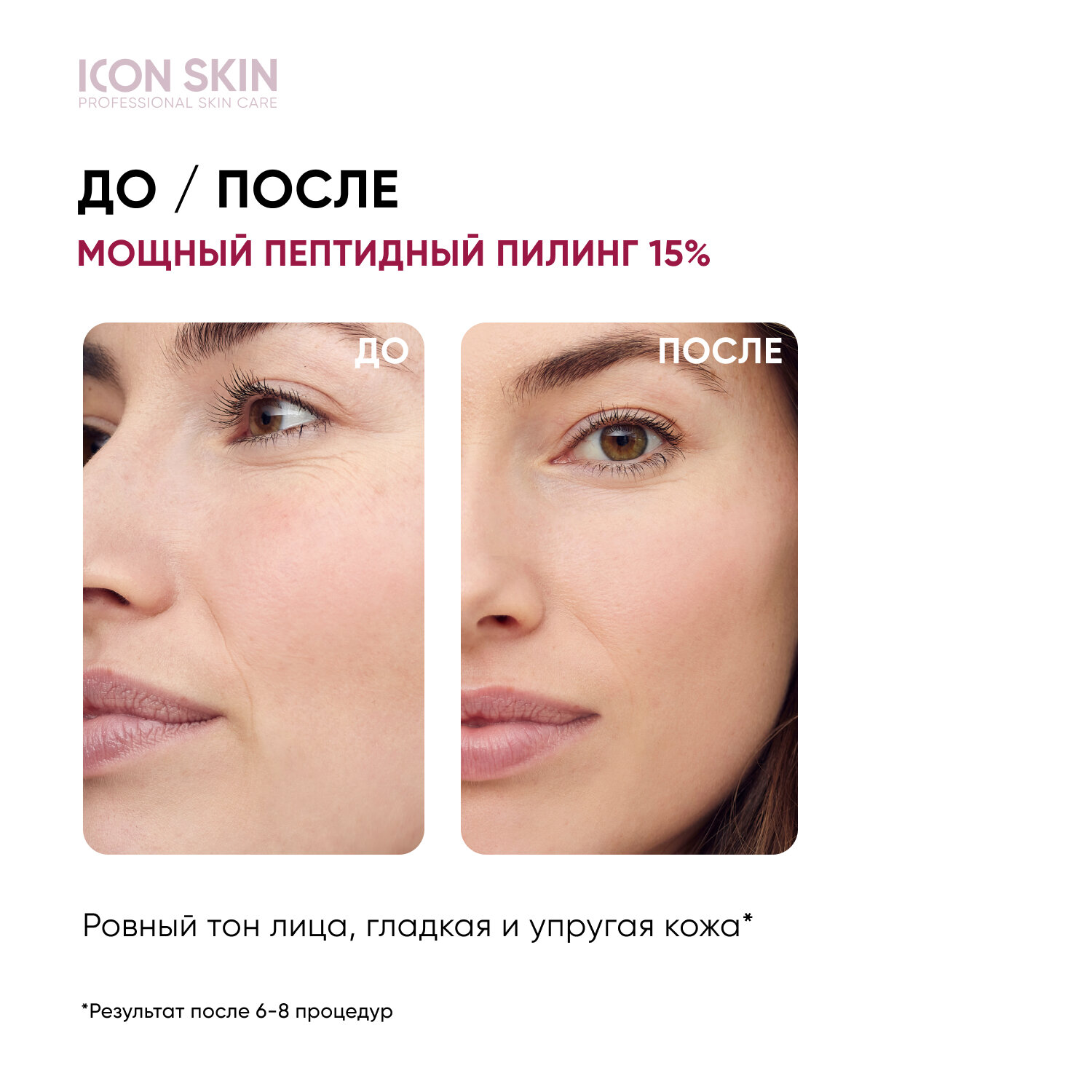 ICON SKIN / Антивозрастной пилинг для лица с 15% комплексом кислот и пептидами для всех типов кожи, 30 мл