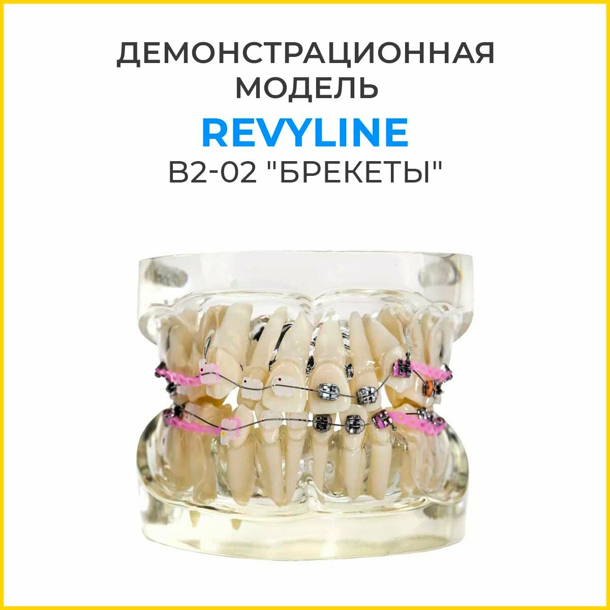 Демонстрационная модель Revyline B2-02 "Брекеты"