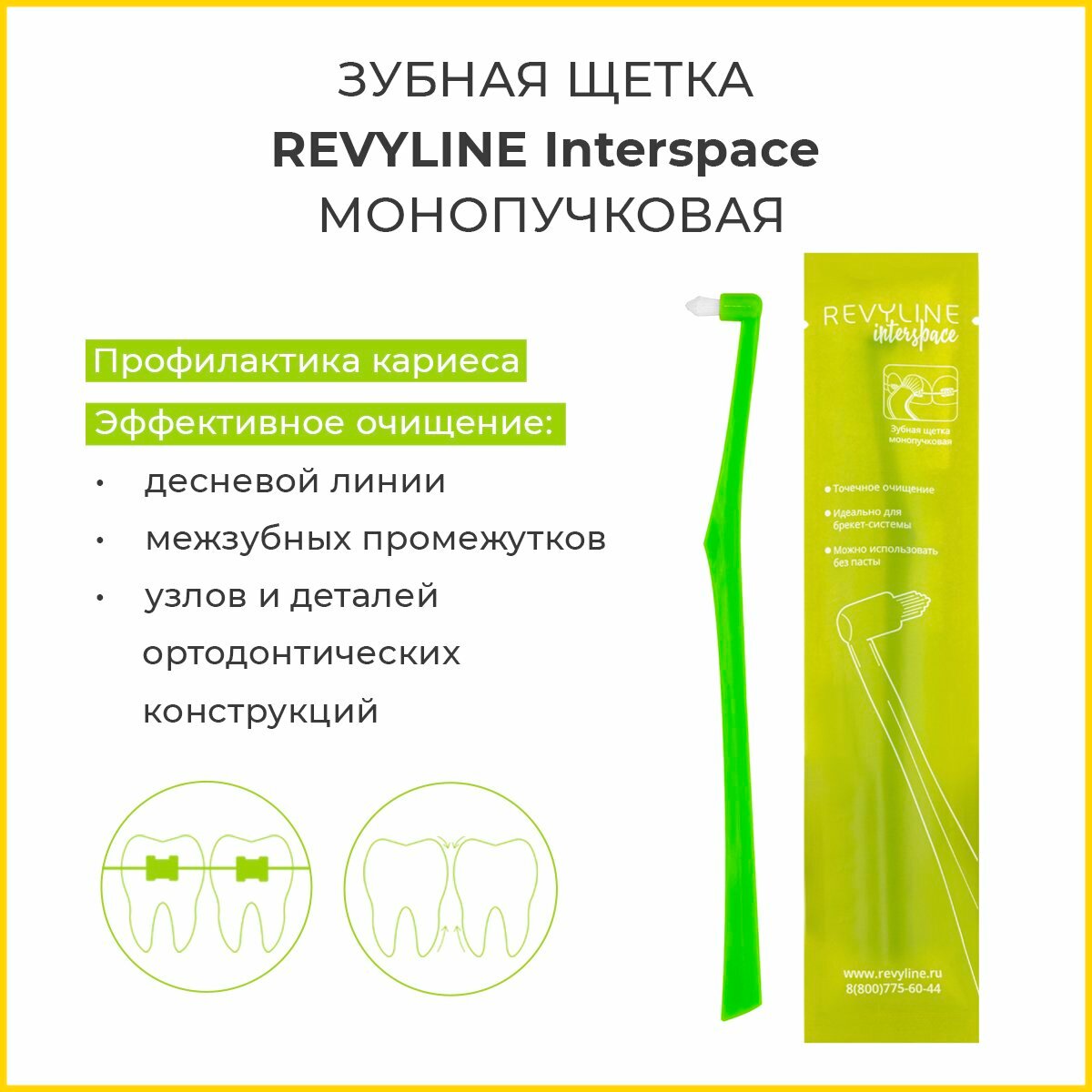 Монопучковая ортодонтическая зубная щетка Revyline Interspace, для брекетов, салатовая, Ревилайн