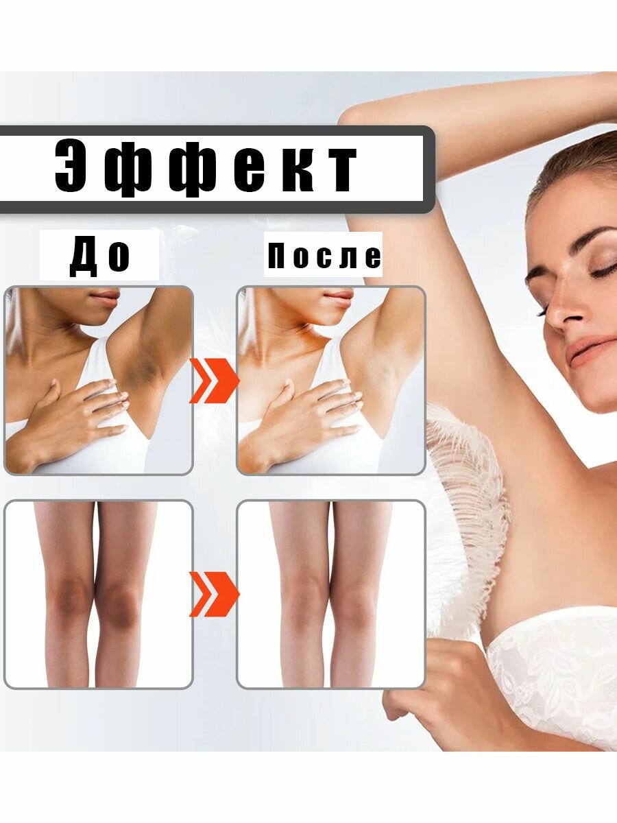 Отбеливающий крем для тела , для интимных зон, подмышек, коленей — фото 1