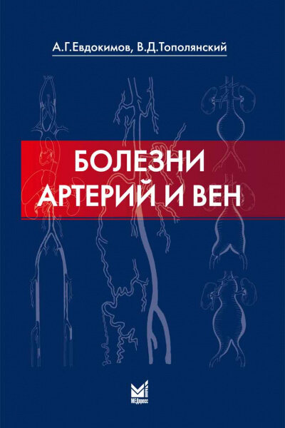 Болезни артерий и вен.