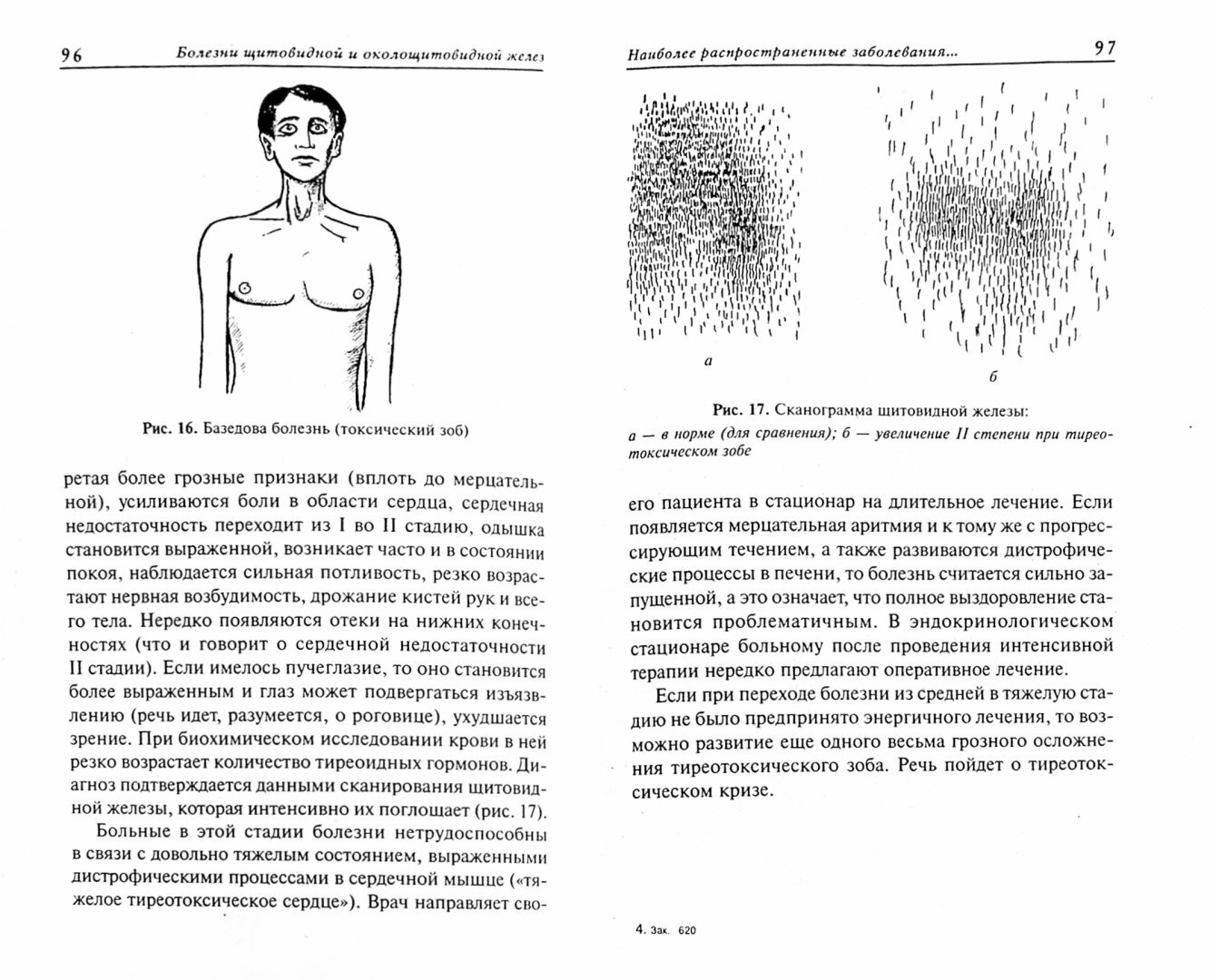 Болезни щитовидной и околощитовидной желез: диагностика, профилактика, лечение - фото №2