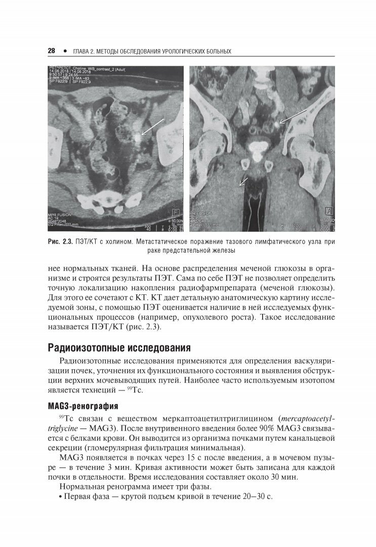 Амбулаторная урология (Пушкарь Дмитрий Юрьевич; Глыбочко Петр Витальевич; Зайцев Андрей Владимирович; Рапопорт Леонид Михайлович) - фото №7