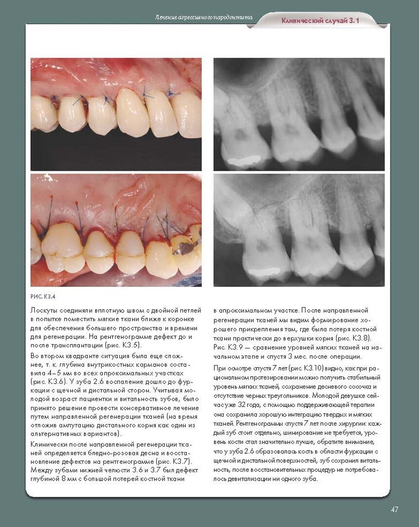 Регенеративные технологии в стоматологии. Научно-практическое руководство - фото №2