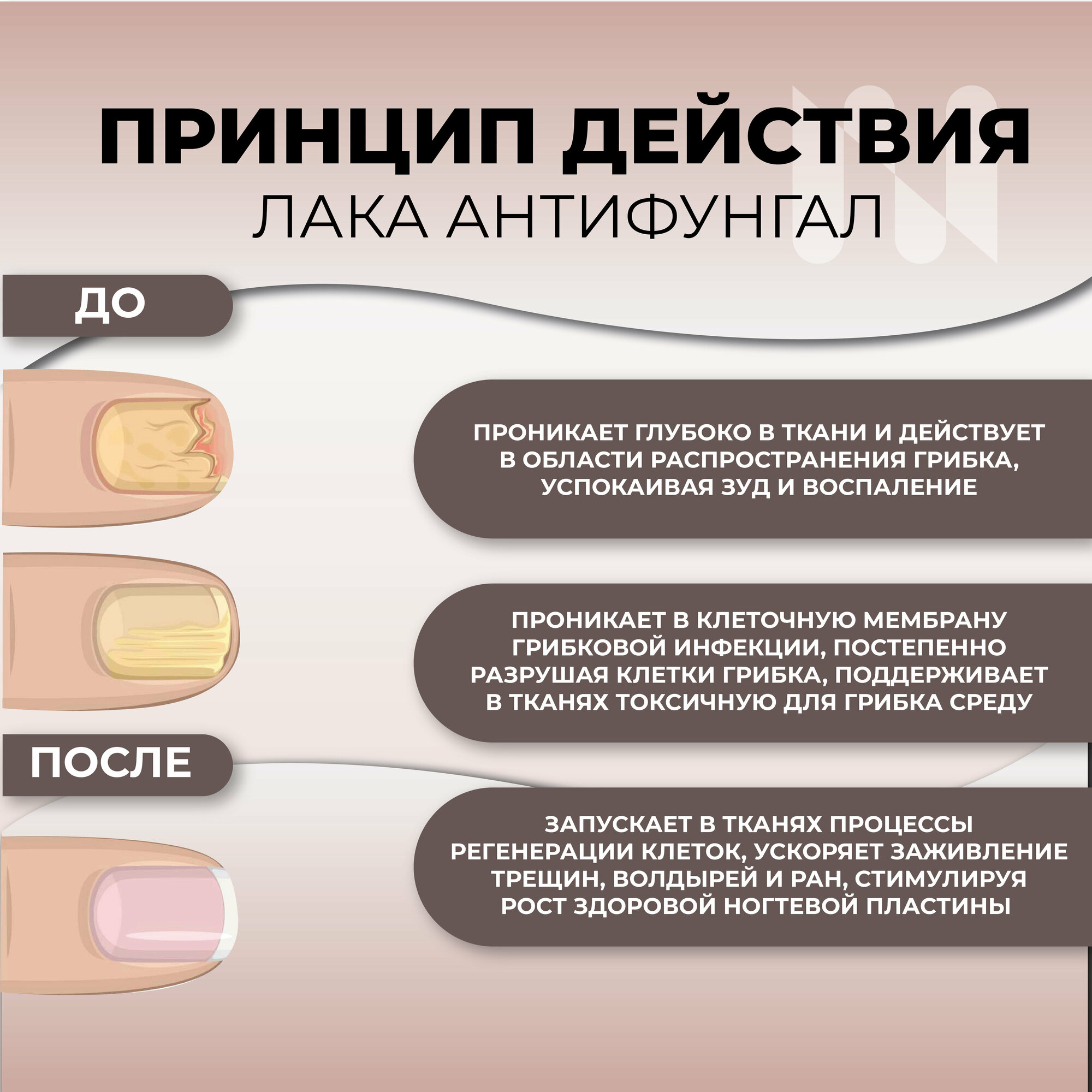 Картинки Лак противогрибковый Masura Antifungal антифунгал, 11 мл 8064S