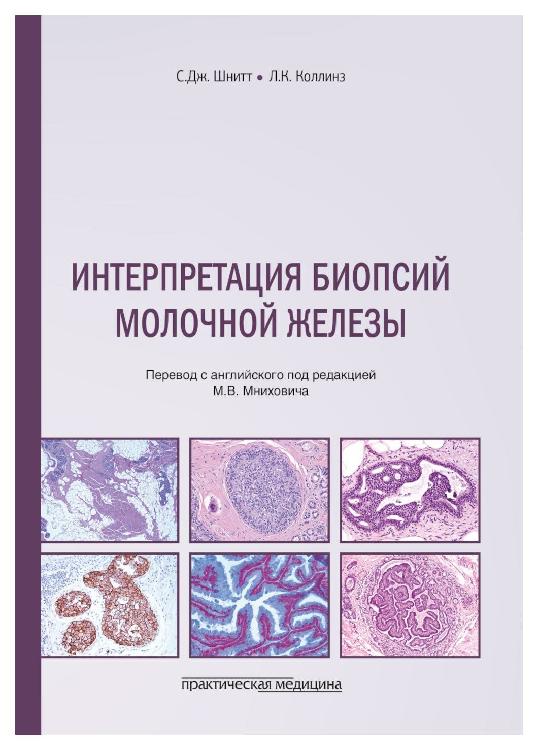 Интерпретация биопсий молочной железы - фото №1