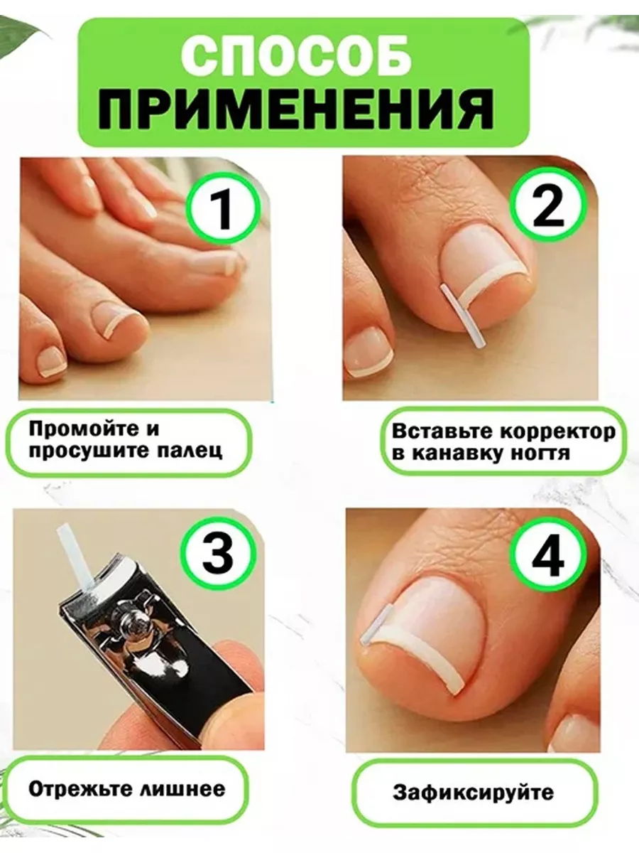 Набор педикюрный QuisLife: пластыри для ногтей, полоски корректоры от вросшего ногтя, кюретка двусторонняя от вросшего ногтя